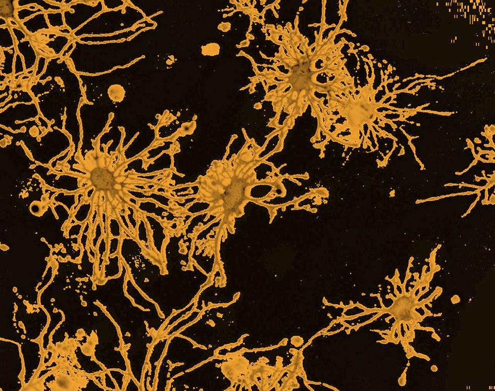 Tencacle Invasion - Sandrine Willaime-Morawek